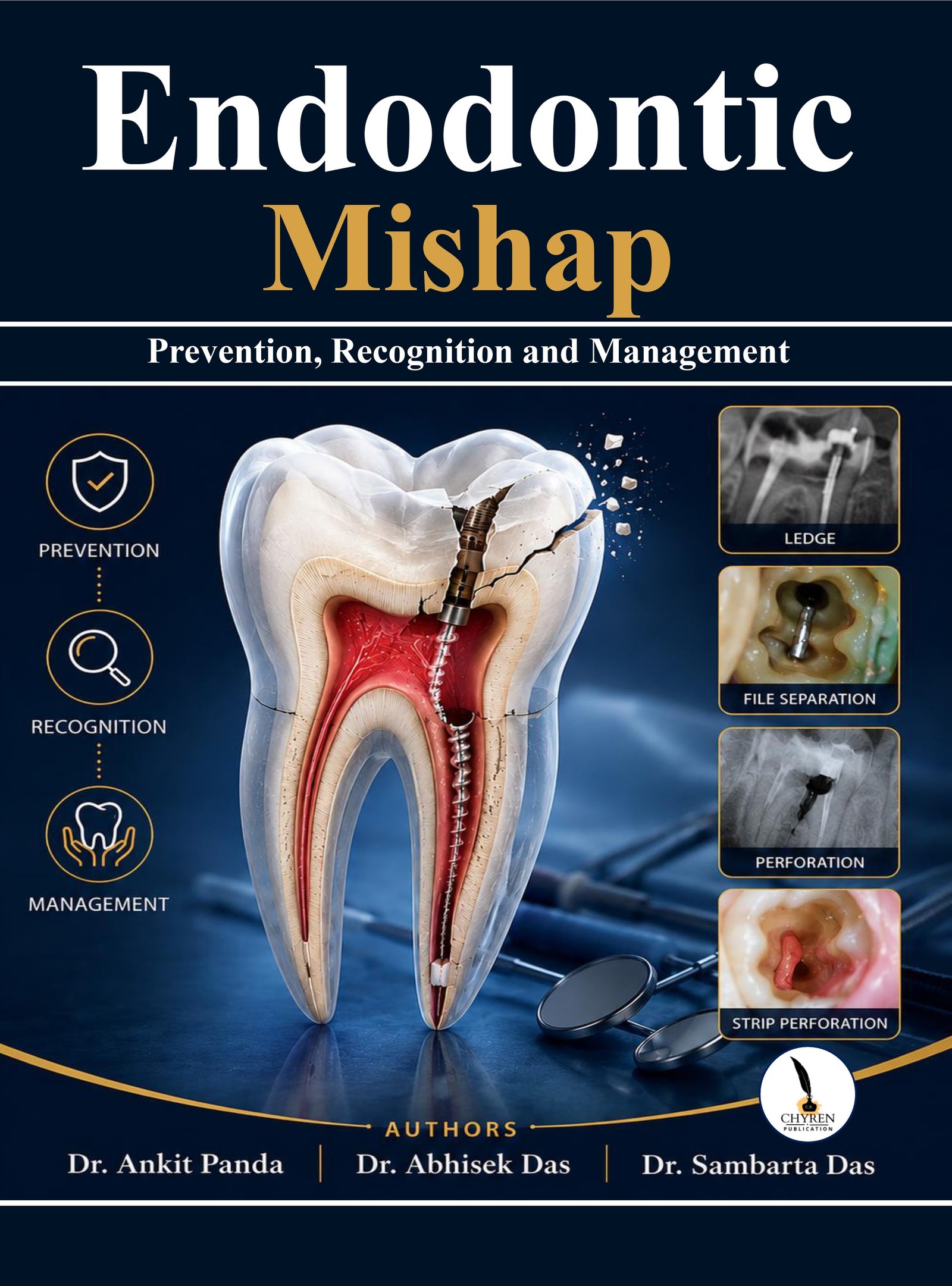 Endodontic mishap- Prevention, Recognition and Management