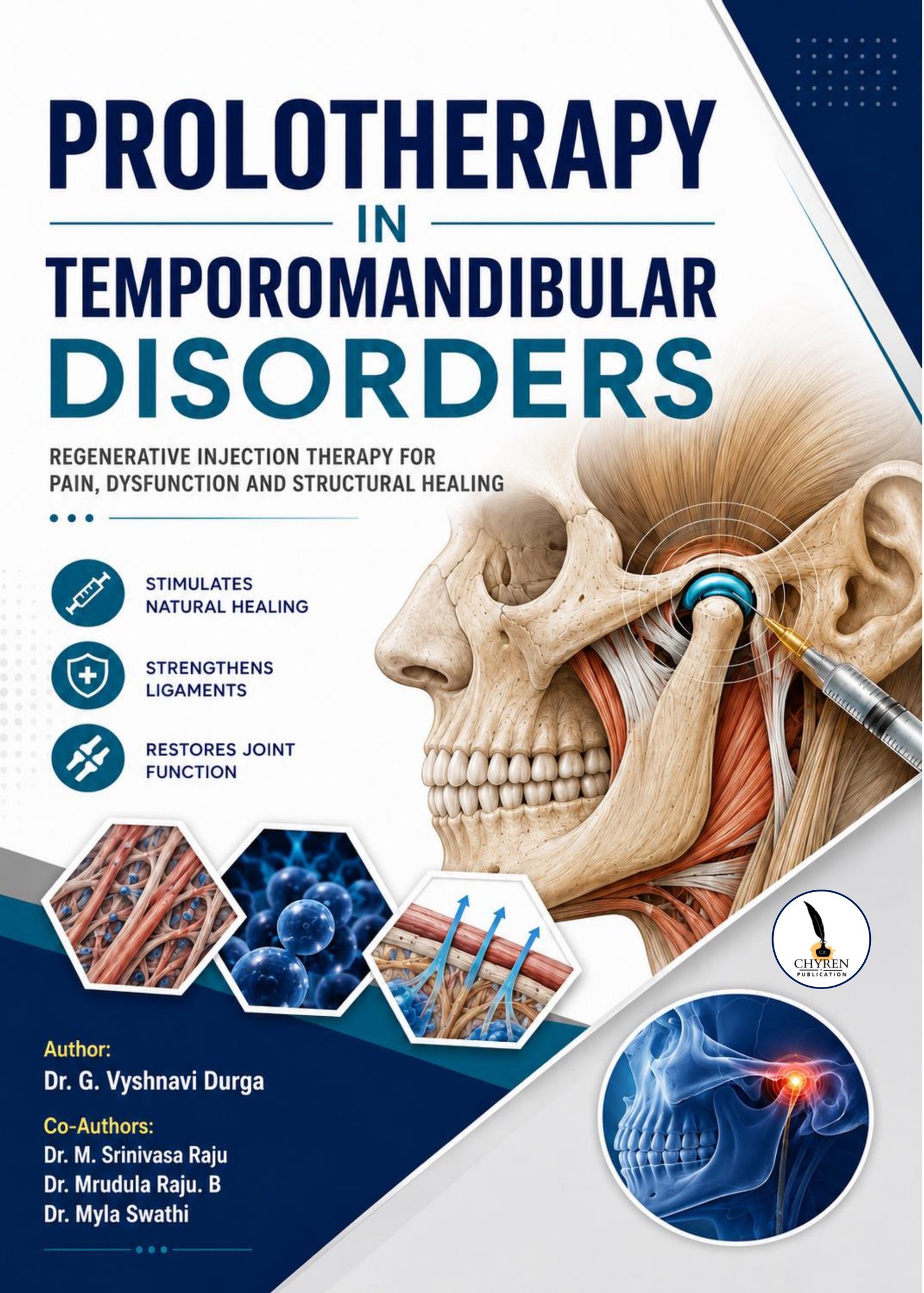PROLOTHERAPY IN TEMPOROMANDIBULAR DISORDERS