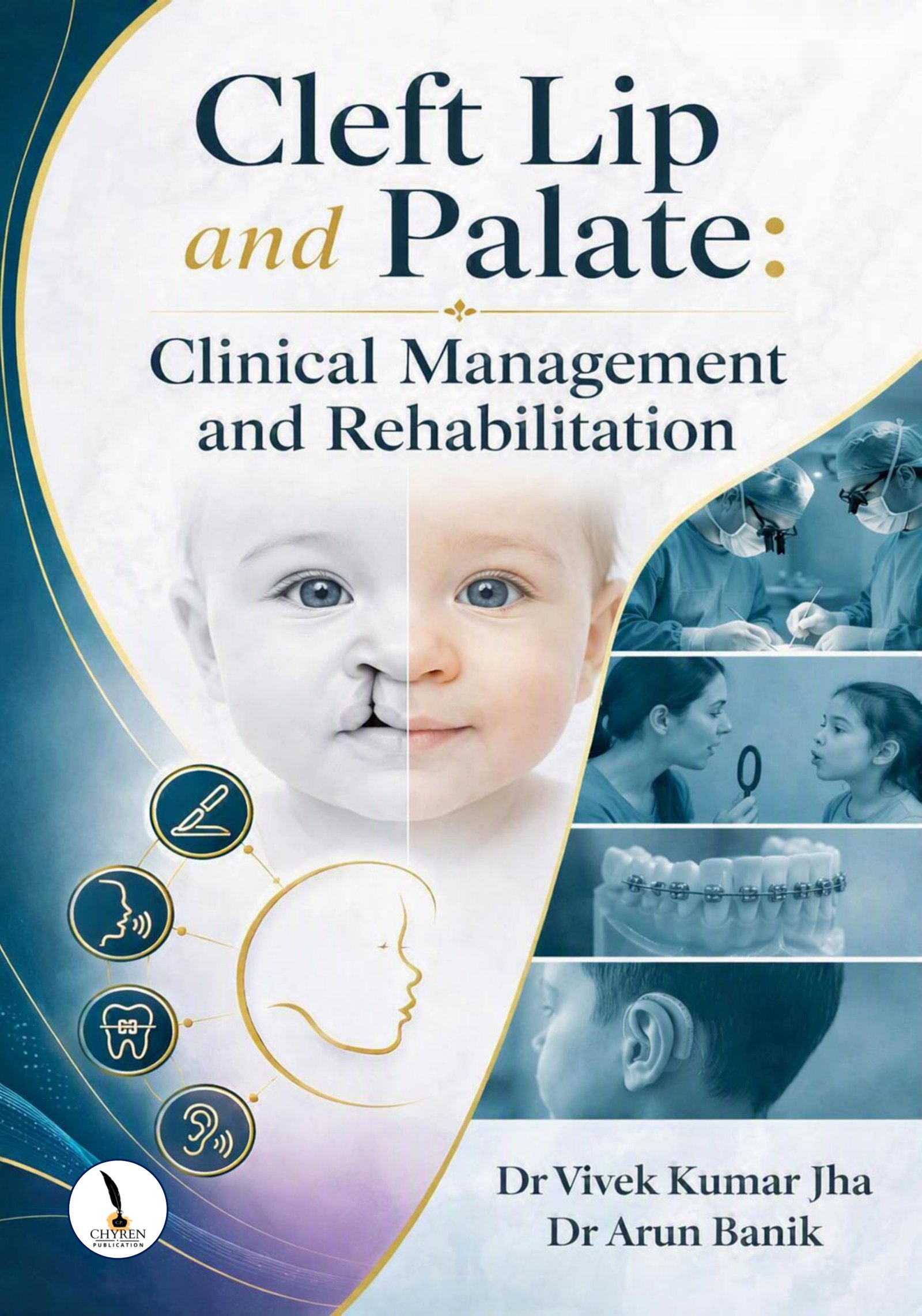 Cleft Lip and Palate: Clinical Management and Rehabilitation
