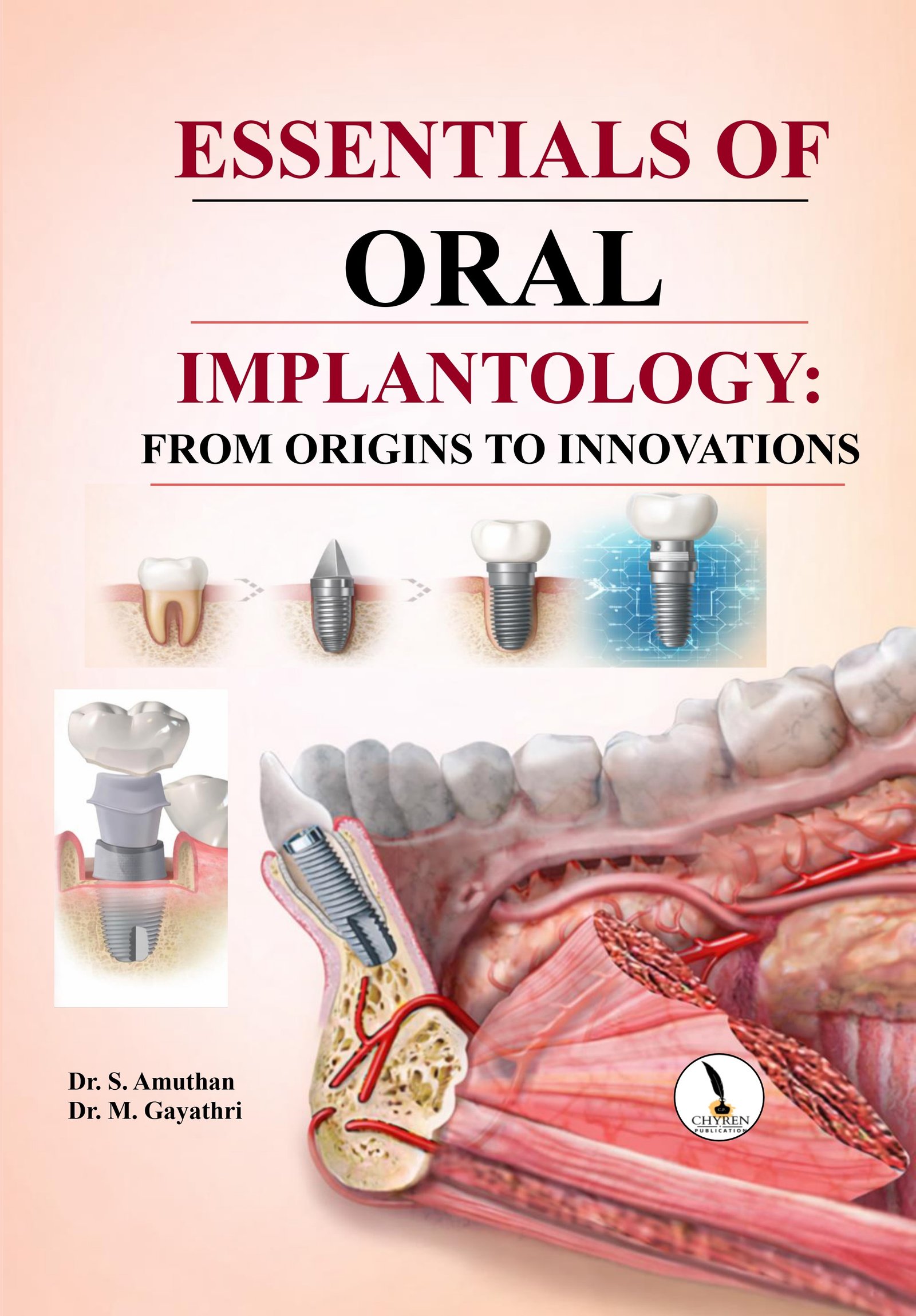 ESSENTIALS OF ORAL IMPLANTOLOGY: FROM ORIGINS TO INNOVATIONS