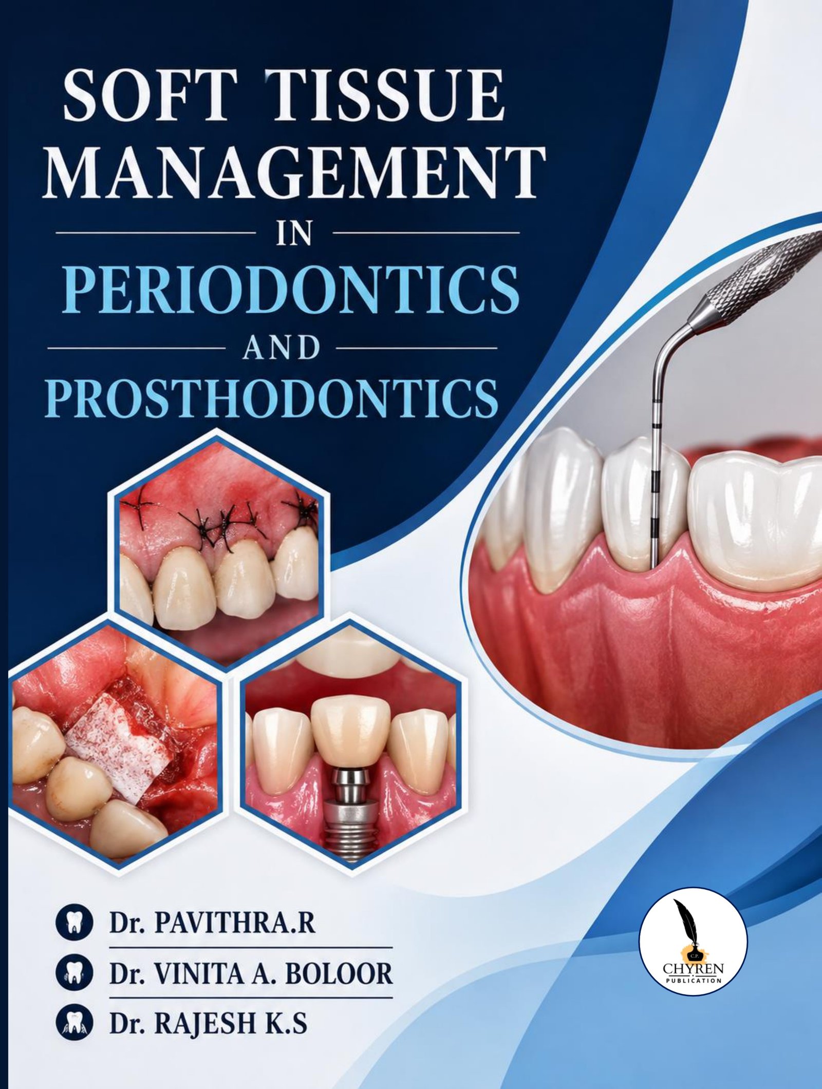 SOFT TISSUE MANAGEMENT IN PERIODONTICS AND PROSTHODONTICS